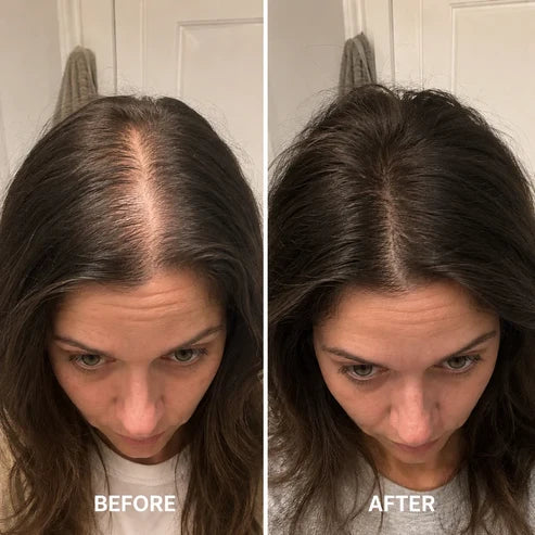 [NEW] Deoxyribose Scalp Serum | For Fuller-Looking Hair & Scalp Strengthening Roll-On Serum