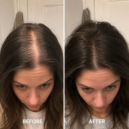 [NEW] Deoxyribose Scalp Serum | For Fuller-Looking Hair & Scalp Strengthening Roll-On Serum