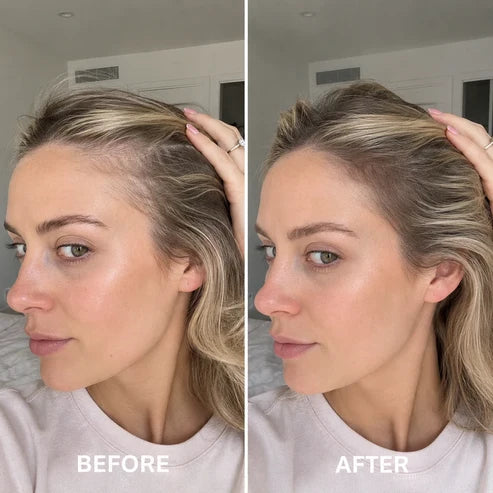 [NEW] Deoxyribose Scalp Serum | For Fuller-Looking Hair & Scalp Strengthening Roll-On Serum
