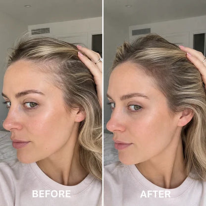 [NEW] Deoxyribose Scalp Serum | For Fuller-Looking Hair & Scalp Strengthening Roll-On Serum