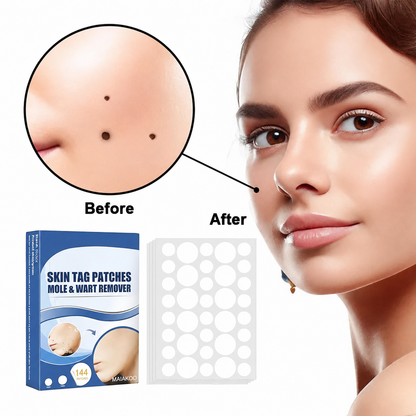 Maiakoo® Skin tag patches mole & wart remover