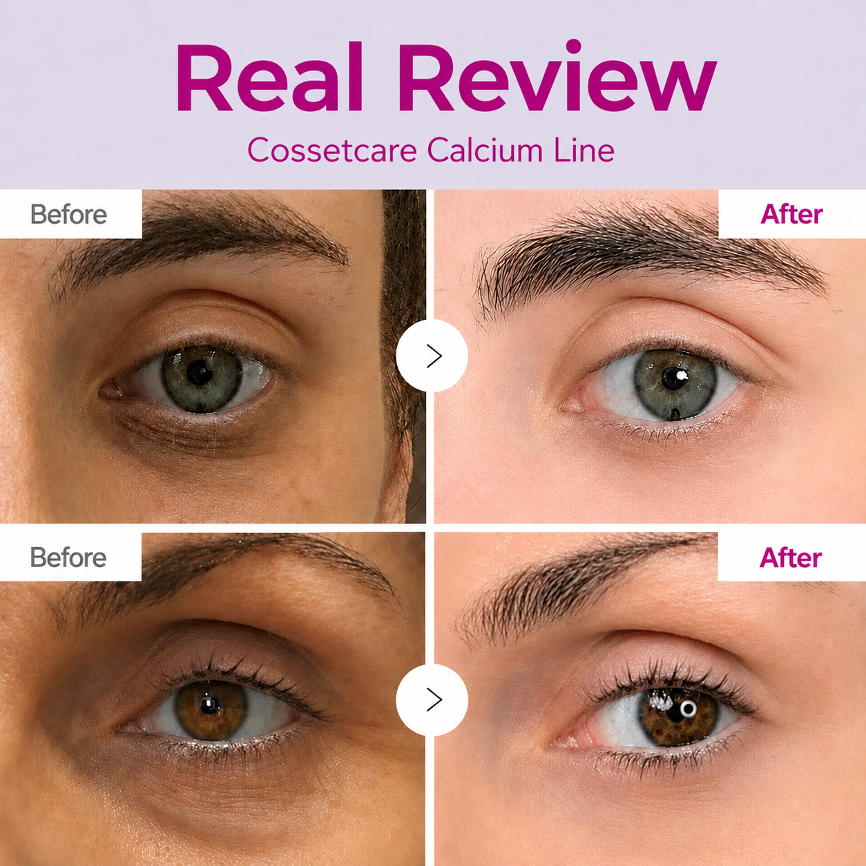 🔥LAST DAY 50% OFF!! Maiakoo Korean Calcium Dark Spot Eye Cream