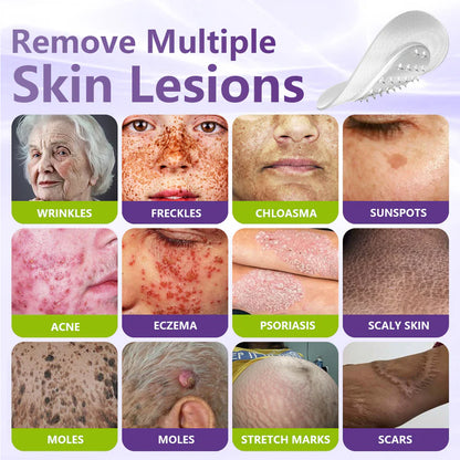 Maiakoo® Soluble Microneedle Botanical Skin Tag Removal Patch