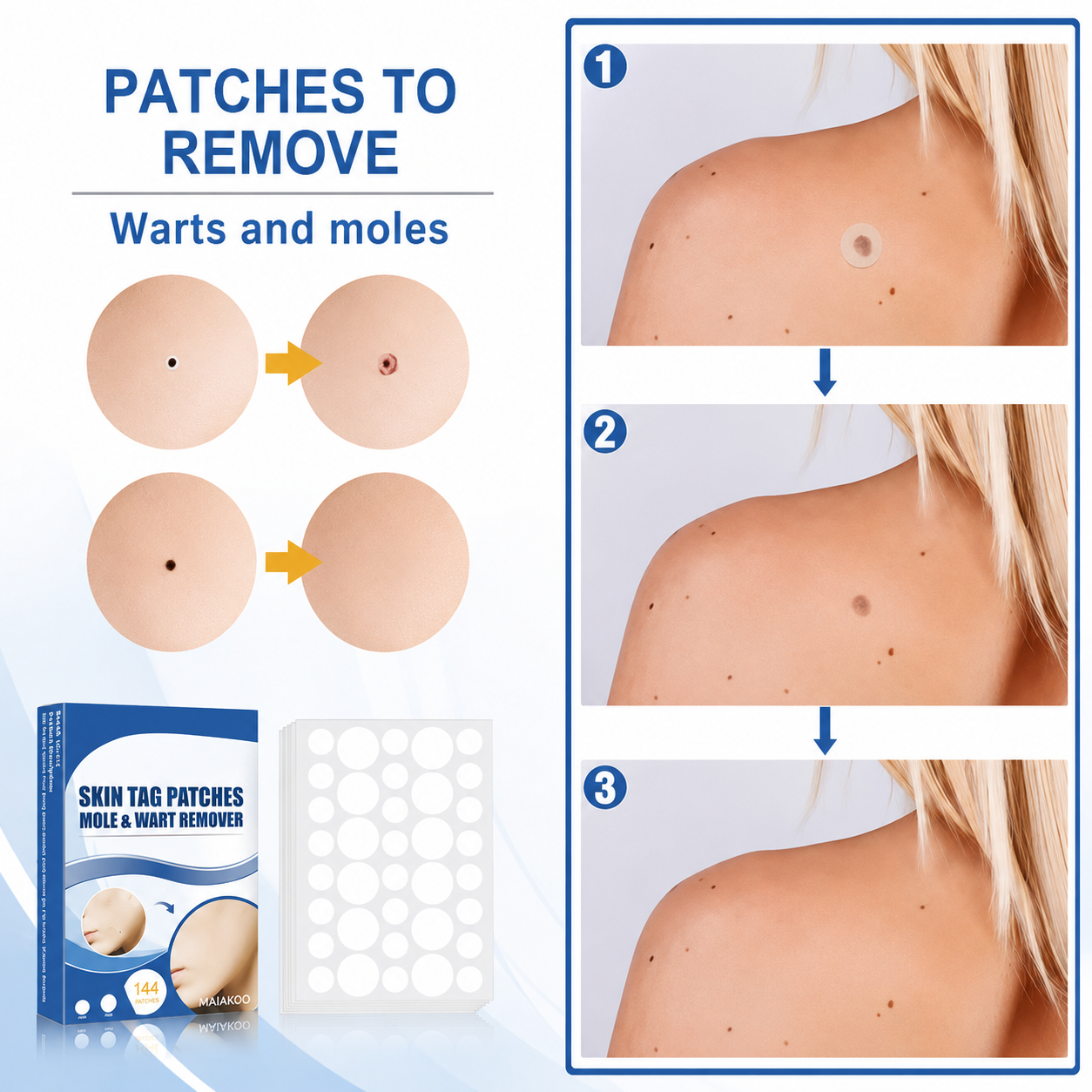Maiakoo® Skin tag patches mole & wart remover