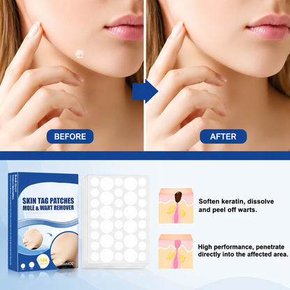 Maiakoo® Skin tag patches mole & wart remover