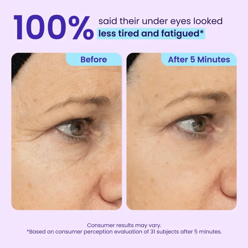 50% DE DESCUENTO · Oferta por tiempo limitado ✨Gel de ojos de efecto lifting instantáneo Maiakoo