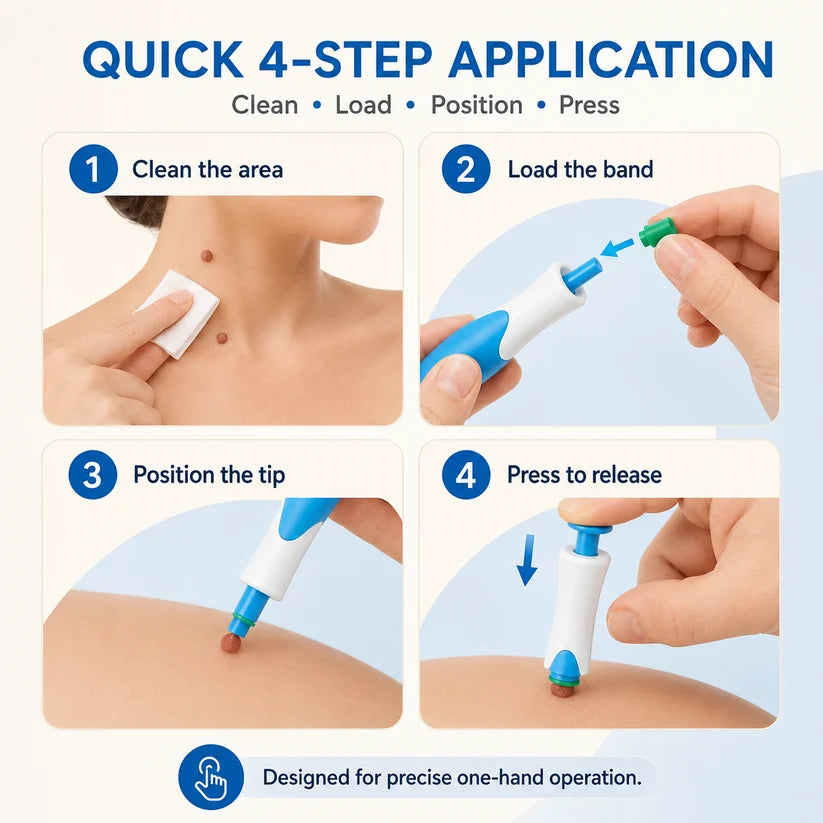 Skin Tag Removal Kit – 2-in-1 Auto Band Applicator with Dual Size Options for At-Home Use