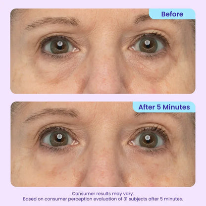 50% DE DESCUENTO · Oferta por tiempo limitado ✨Gel de ojos de efecto lifting instantáneo Maiakoo