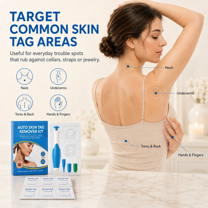Skin Tag Removal Kit – 2-in-1 Auto Band Applicator with Dual Size Options for At-Home Use