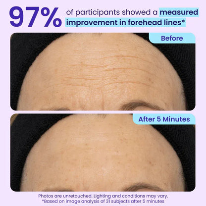 50% DE DESCUENTO · Oferta por tiempo limitado ✨Gel de ojos de efecto lifting instantáneo Maiakoo