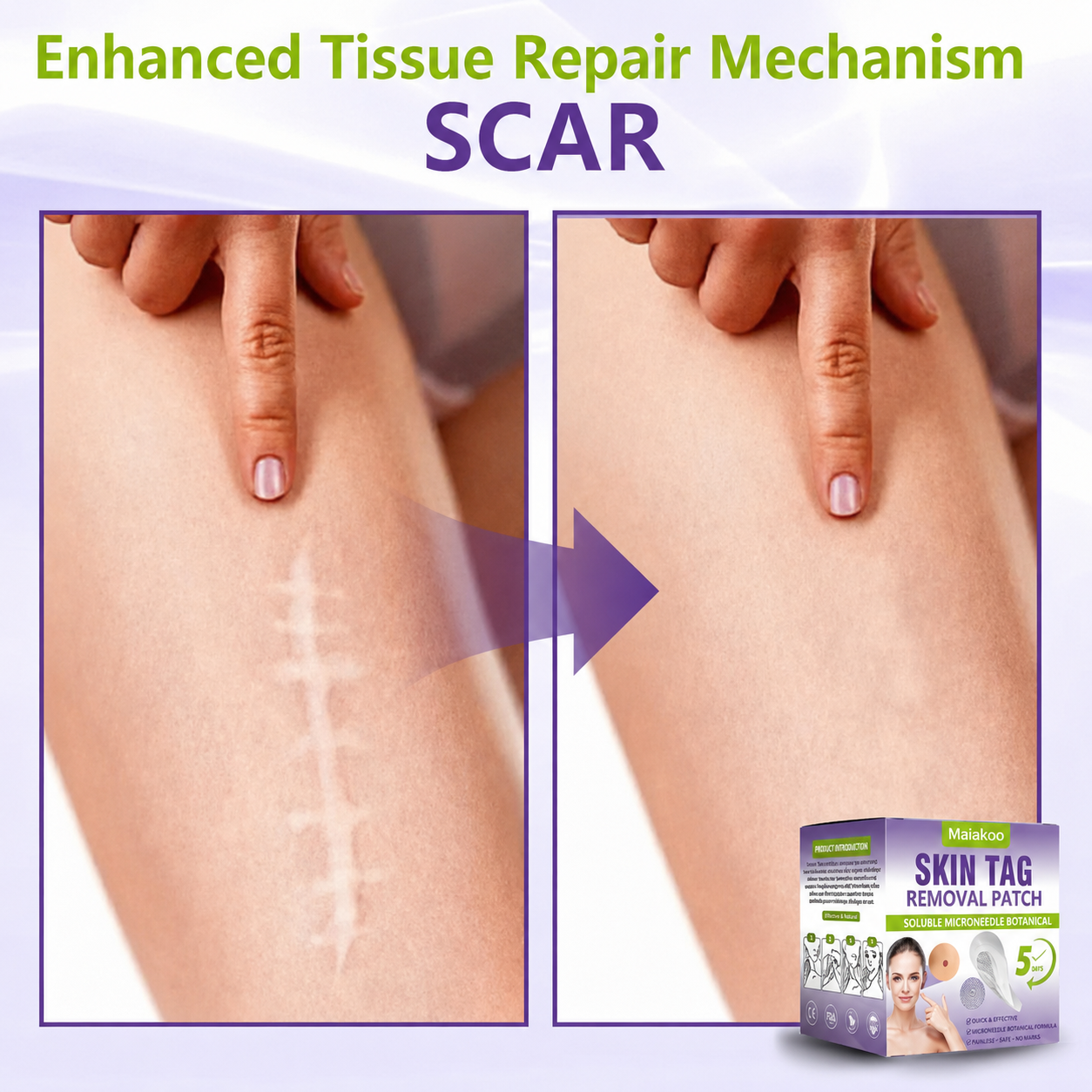 Maiakoo® Soluble Microneedle Botanical Skin Tag Removal Patch