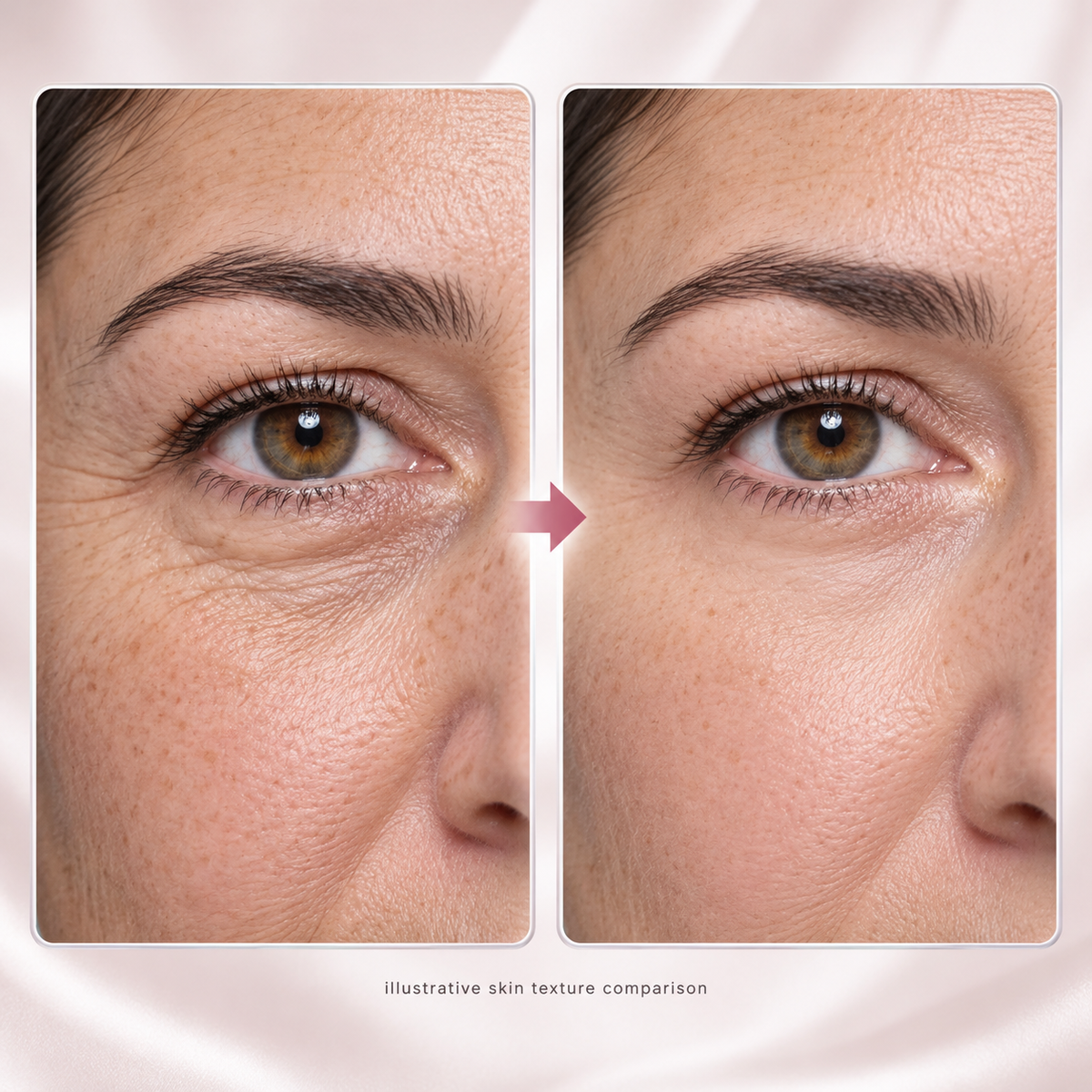 Eye Renewal Crème – 3-in-1 Red Light & Microcurrent Eye Care
